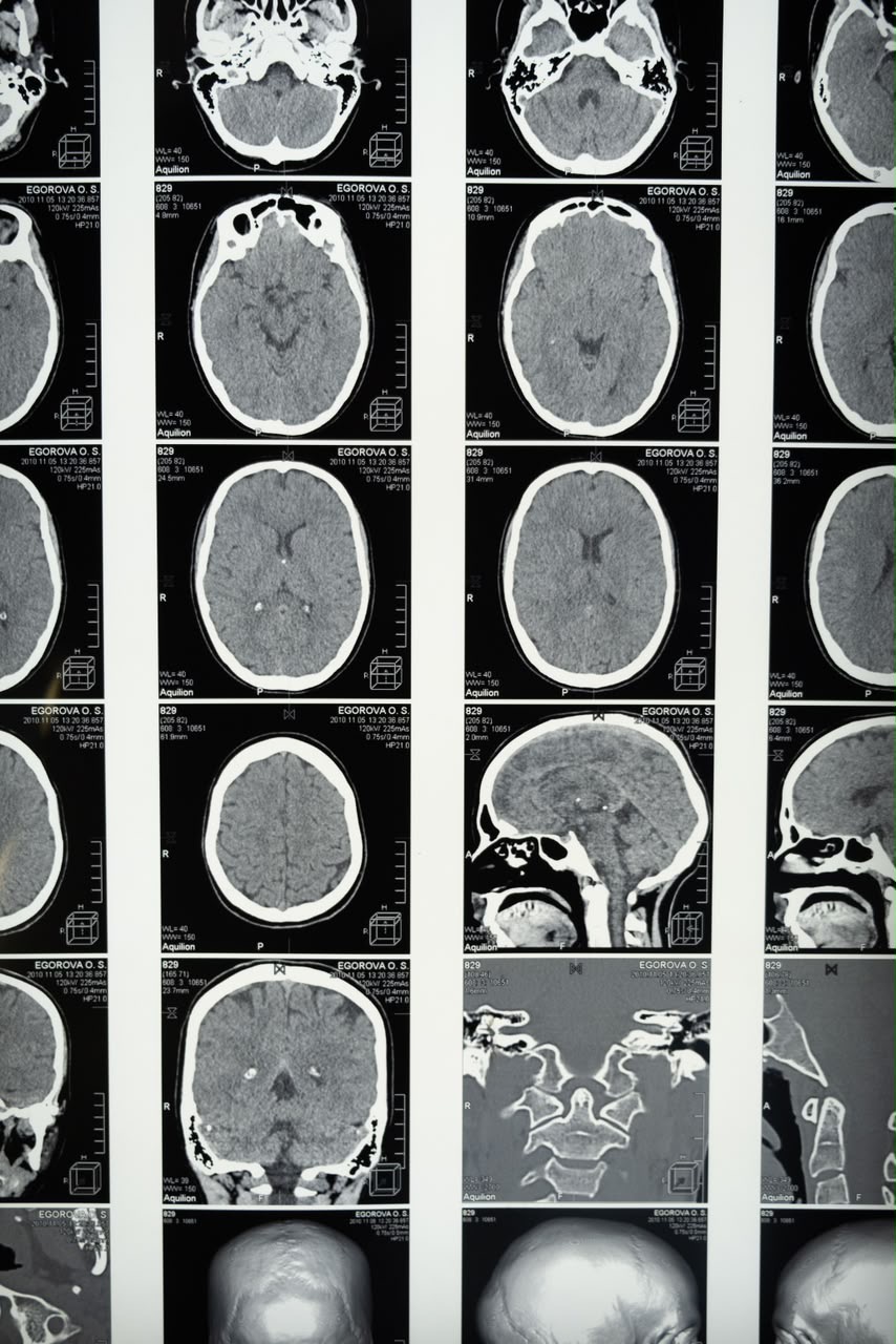 CT scan sample