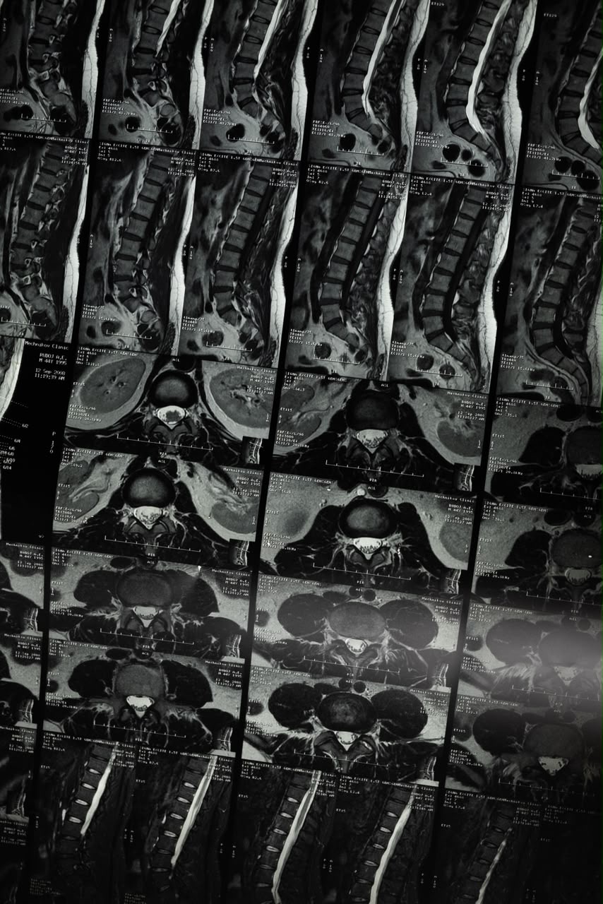 MRI sample