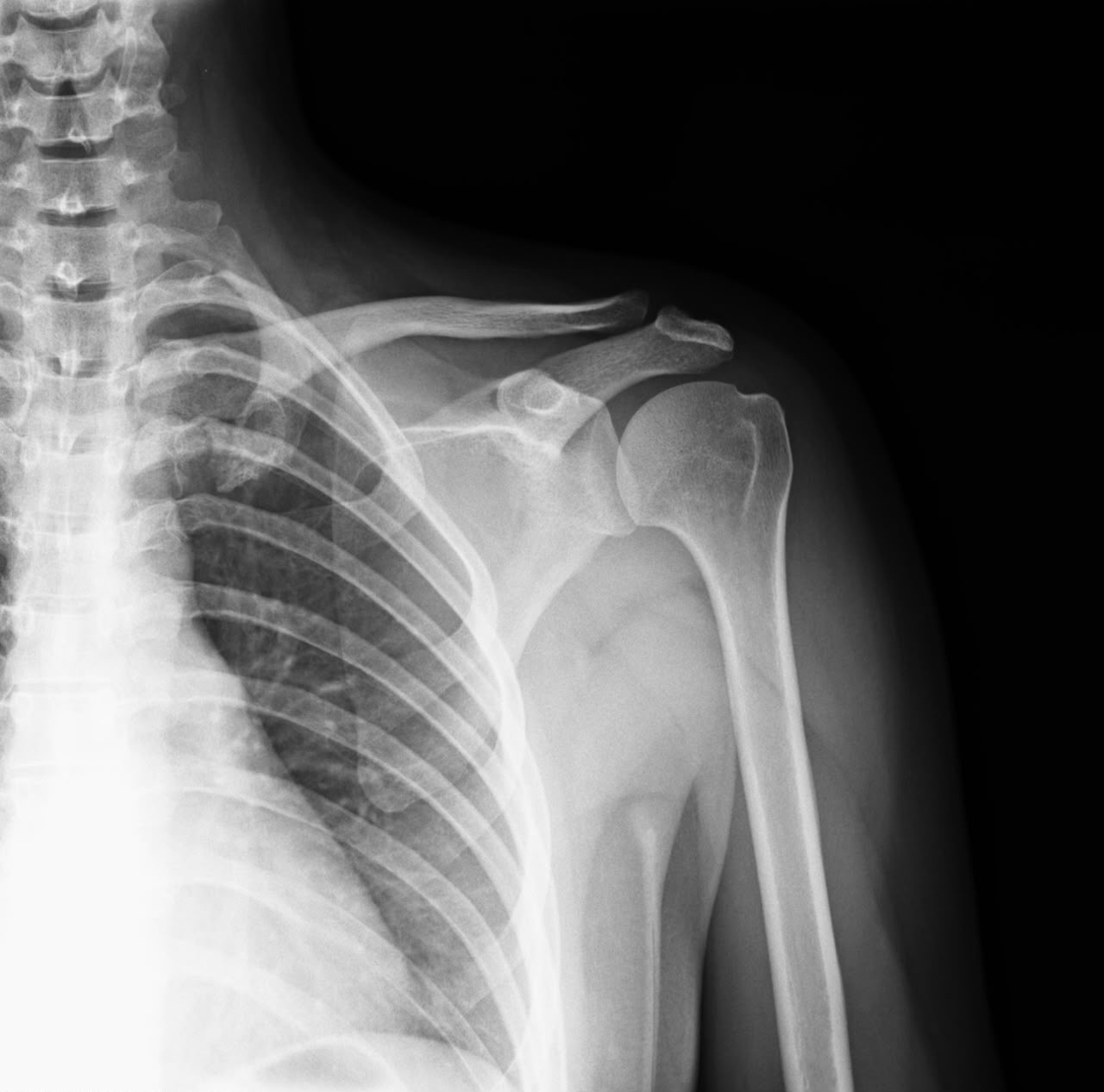 X-ray sample